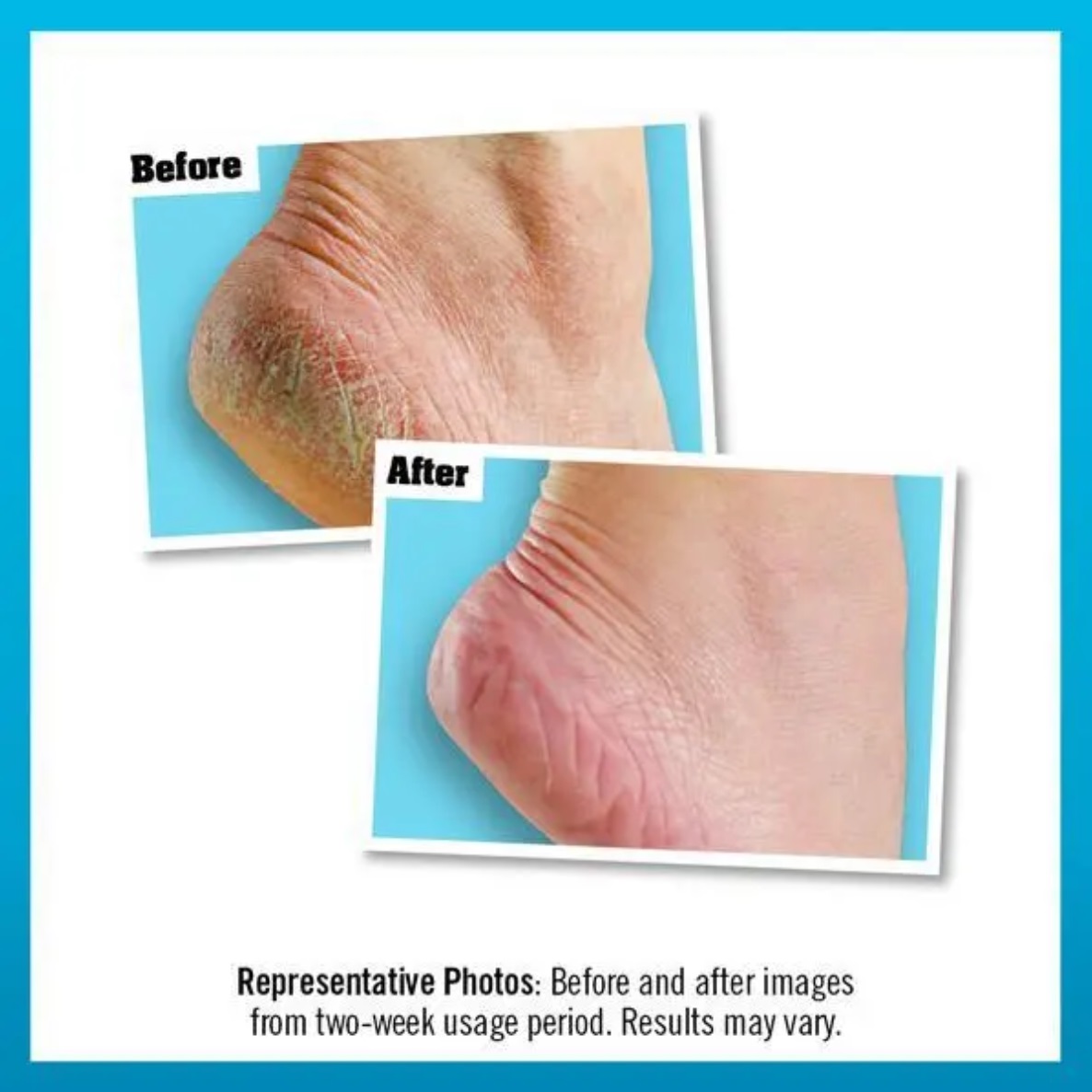 O Keeffe s Healthy Feet Creme Für Extrem Trockene Krackende Füße Glas - Image 3